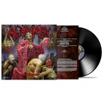 Autopsy